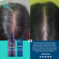Suu Balm Gentle Moisturising Anti Dandruff Shampoo