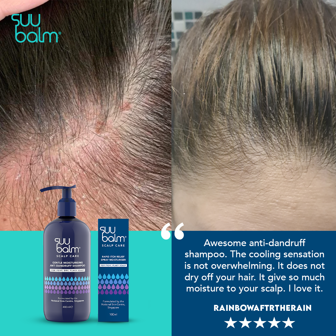 Suu Balm Rapid Itch Relief Scalp Spray Moisturiser