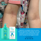 Suu Balm Kids Ceramide Moisturiser (Gentle Itch Relief)